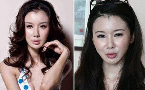 张檬整容前后对比_娱乐圈没整过容的明星_整容毁掉事业的女明星