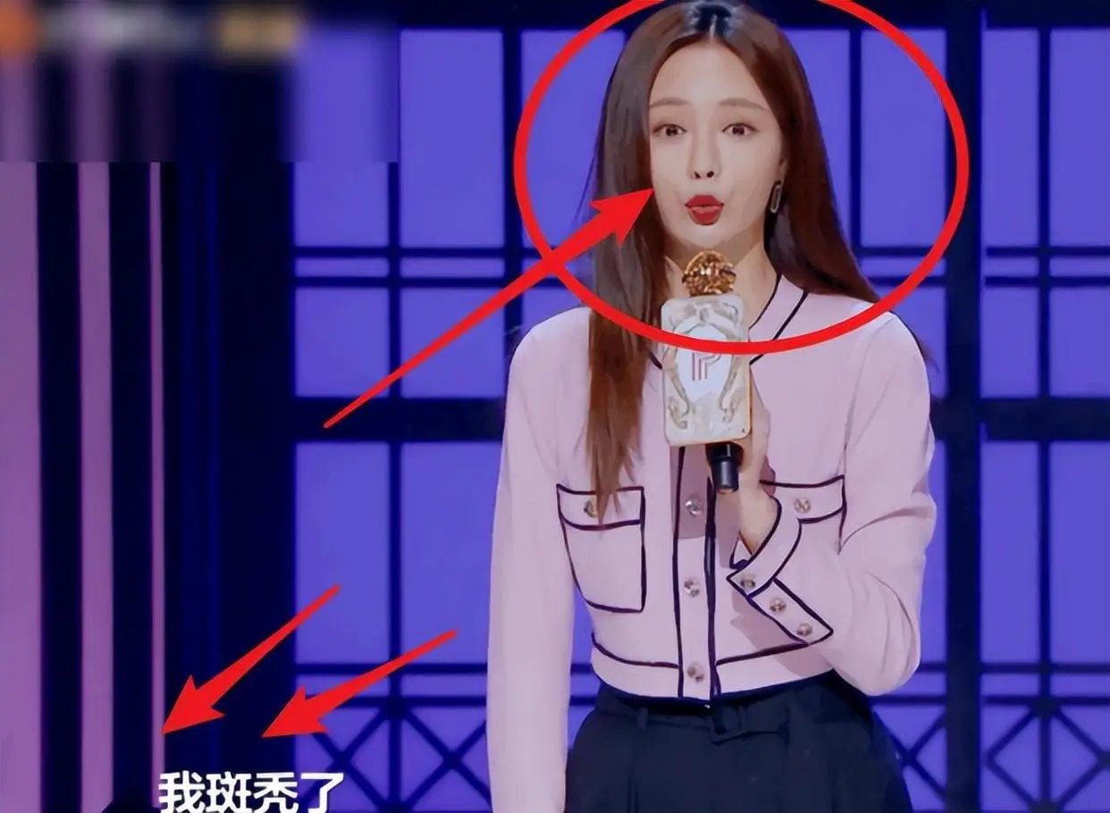 发量少的女明星有哪些_女明星脱发严重_杨幂赵丽颖金晨假发片